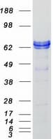 Human ZBTB3 Protein (Recombinant Myc-DDK (Flag))