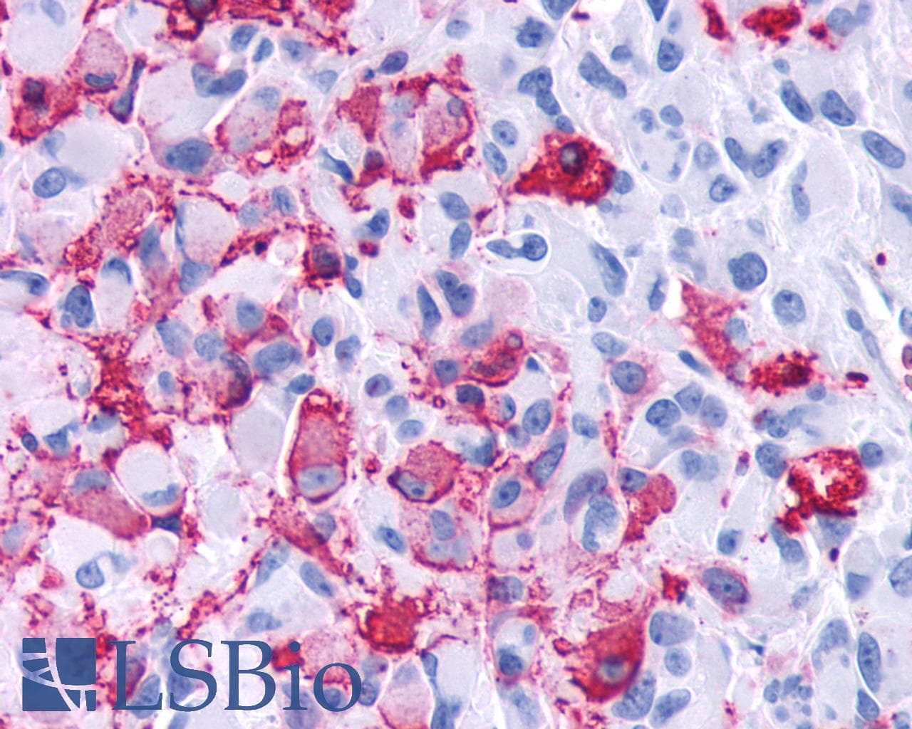 IHC-plus™ FZD4 / Frizzled 4 Antibody (N-Terminus)
