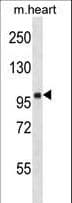 FHOS / FHOD1 Antibody (aa985-1013)
