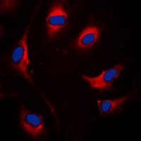 Polyclonal Rabbit anti-Human SOCS1 Antibody (Internal, IF, WB)