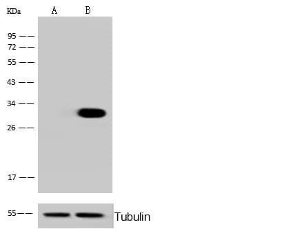 Polyclonal Rabbit anti-Human PHAP1 / ANP32A Antibody (Preservative Free, IHC, IF, WB)