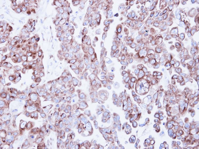 Polyclonal Rabbit anti-Human RRBP1 / hES Antibody (aa1183-1410, IHC, WB)