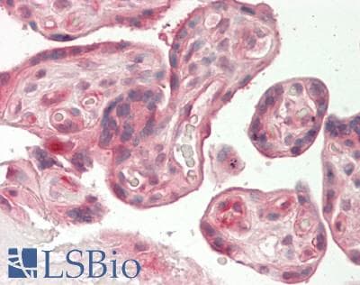 Polyclonal Rabbit anti-Human ADIPOR2 Antibody (C-Terminus, IHC, WB)