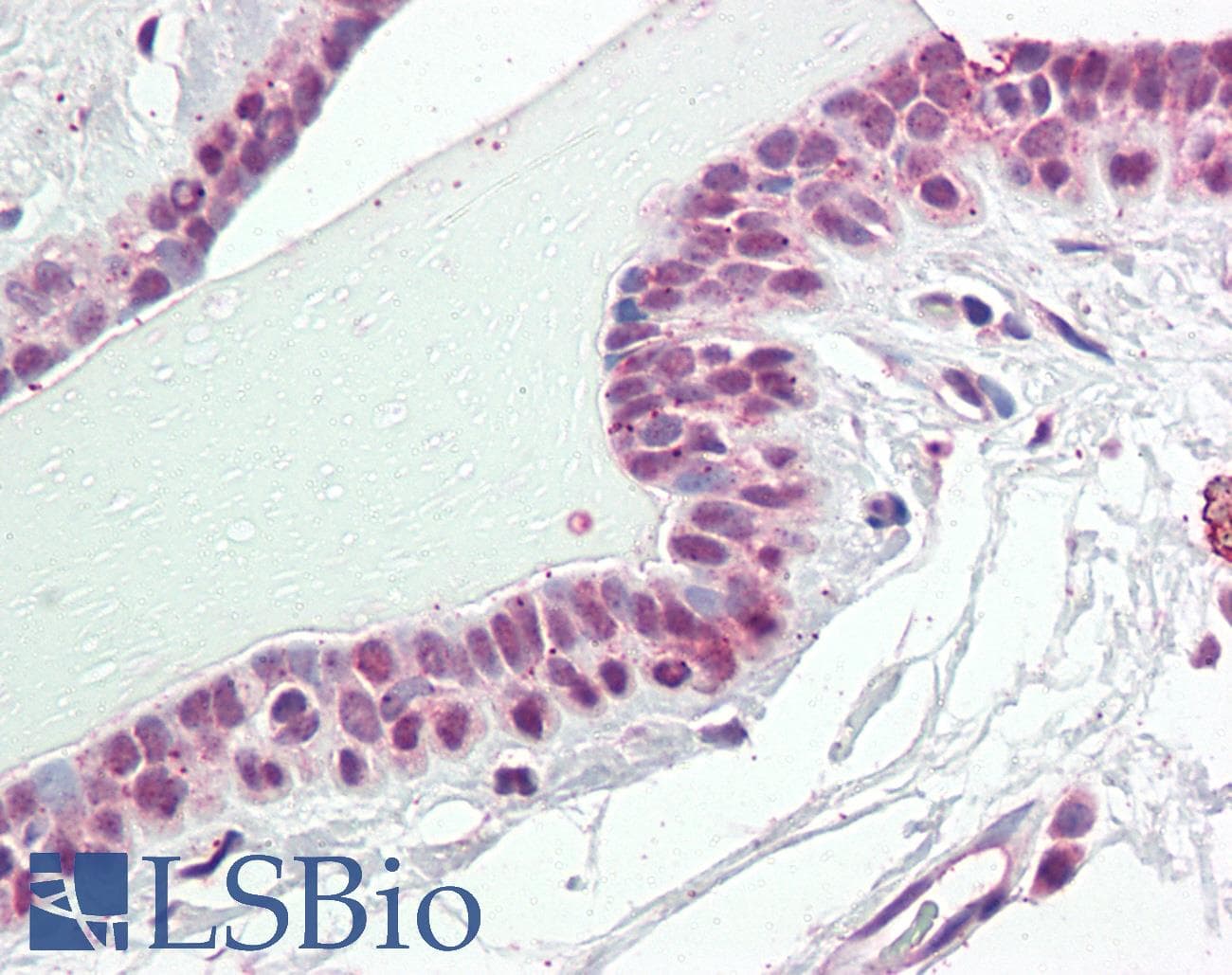IHC-plus™ NUP210 / gp210 Antibody (C-Terminus)