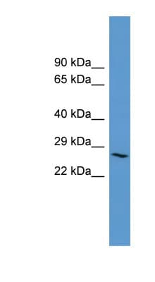 Polyclonal Rabbit anti-Human ADORA3 / Adenosine A3 Receptor Antibody (aa195-244, WB)
