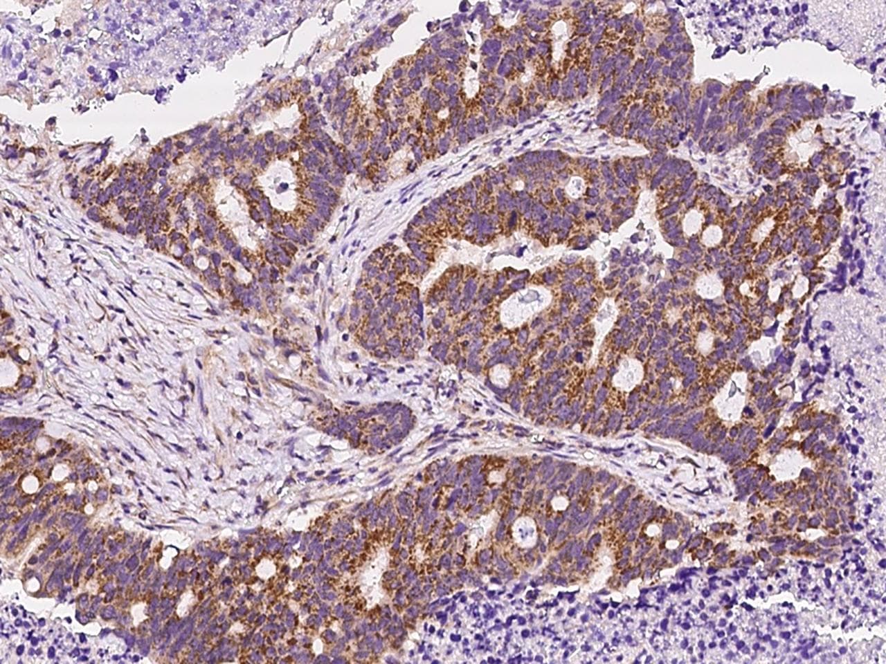 DKK3 Antibody (Preservative Free)