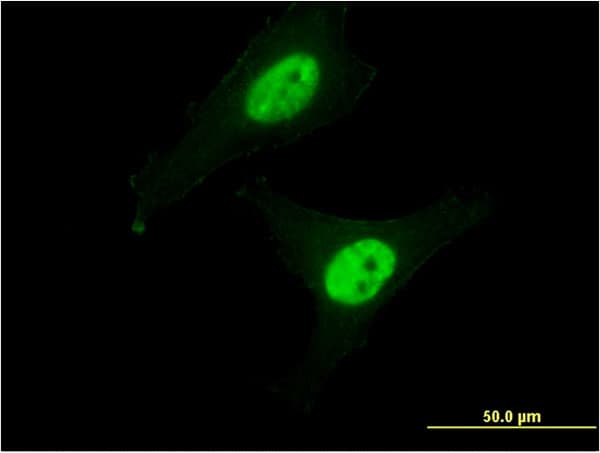 Monoclonal Mouse anti-Human CAPN3 / Calpain 3 Antibody (clone 1B2, IF, WB)