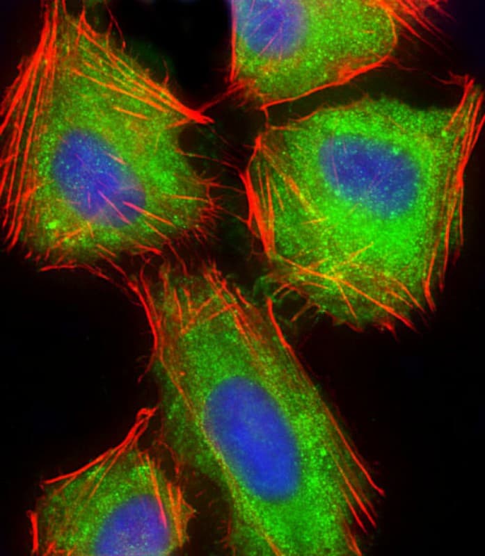 ARPC5 / p16-Arc Antibody (Internal)