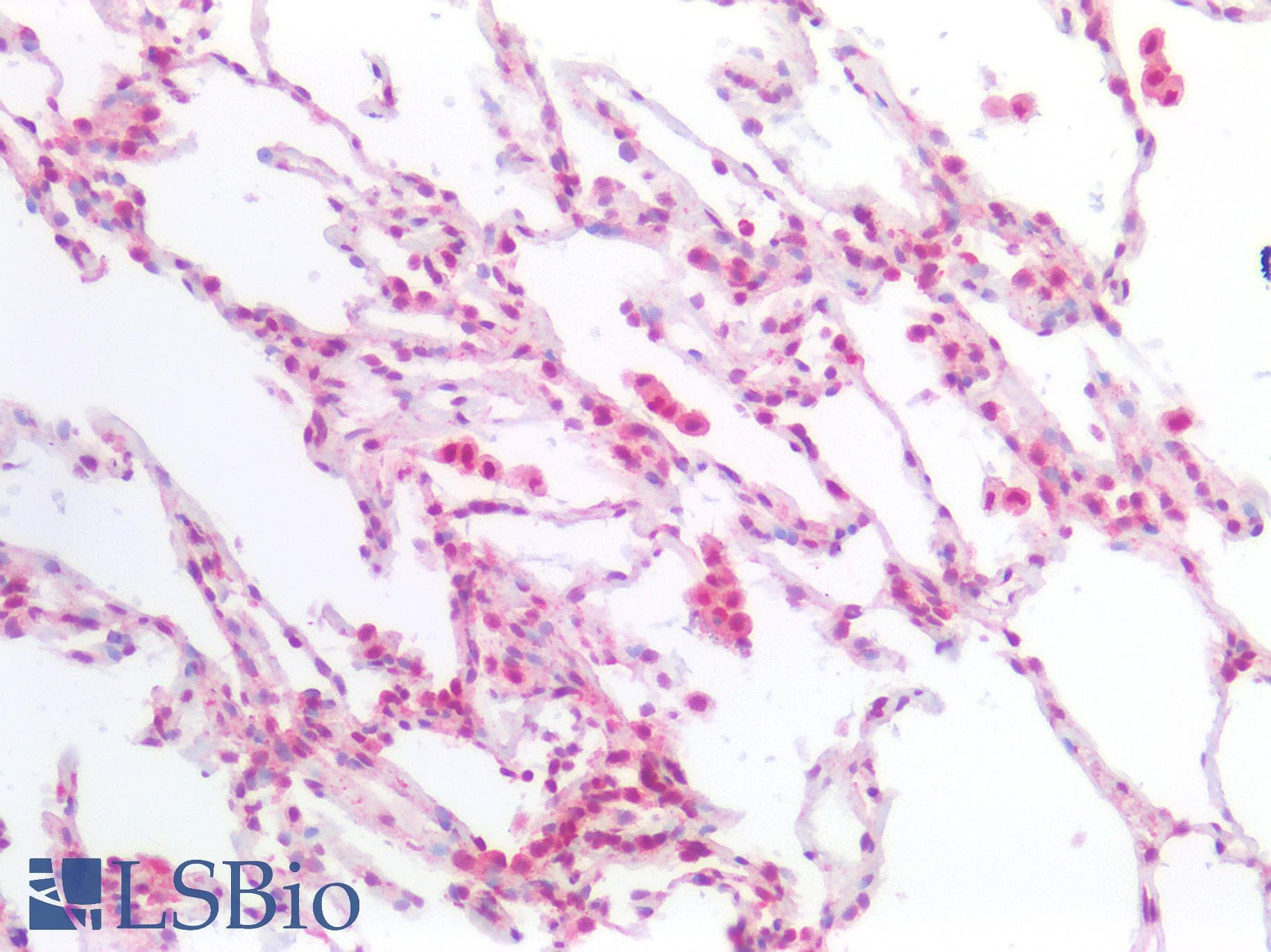 PathPlus™ STK11 / LKB1 Antibody