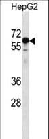 Polyclonal Rabbit anti-Human KLHL25 Antibody (aa62-91, WB)