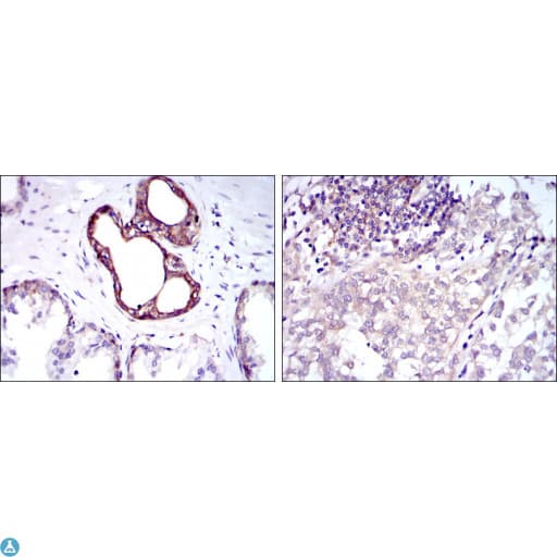 Monoclonal Mouse anti-Human NFKB1 / NF-Kappa-B Antibody (IHC, WB)