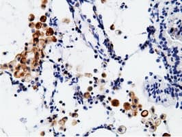 Monoclonal Mouse anti-Human CD80 Antibody (clone OTI2E5, IHC, IF, WB)