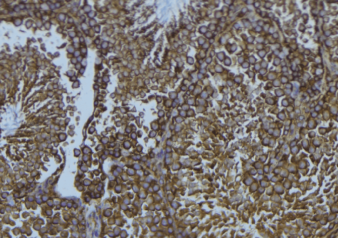 CYP1B1 Antibody