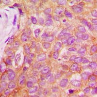 IRS1 Antibody (phospho-Ser1101)