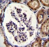 ITGA8 / Integrin Alpha 8 Antibody (aa1025-1053)