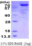 Human TARS Protein (Recombinant His)