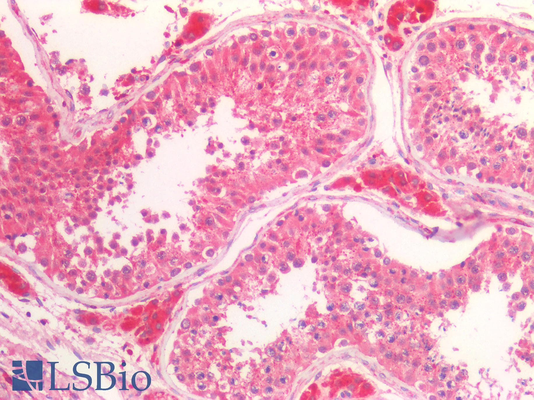 IHC-plus™ Polyclonal Rabbit anti-Human CTSV / Cathepsin V Antibody (aa105-334, IHC, WB)