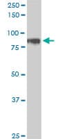 HIC1 Antibody (clone 4E11)
