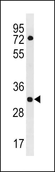 Polyclonal Rabbit anti-Human HLA-DOA Antibody (aa31-59, WB)