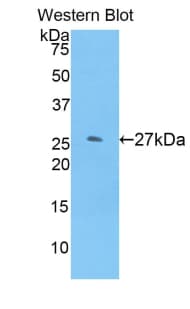 GSTM1 Antibody (aa1-218)