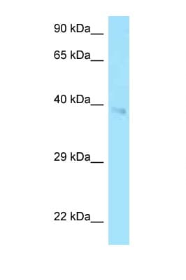 CD2 Antibody (aa177-226)