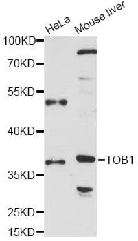TOB1 / TOB Antibody