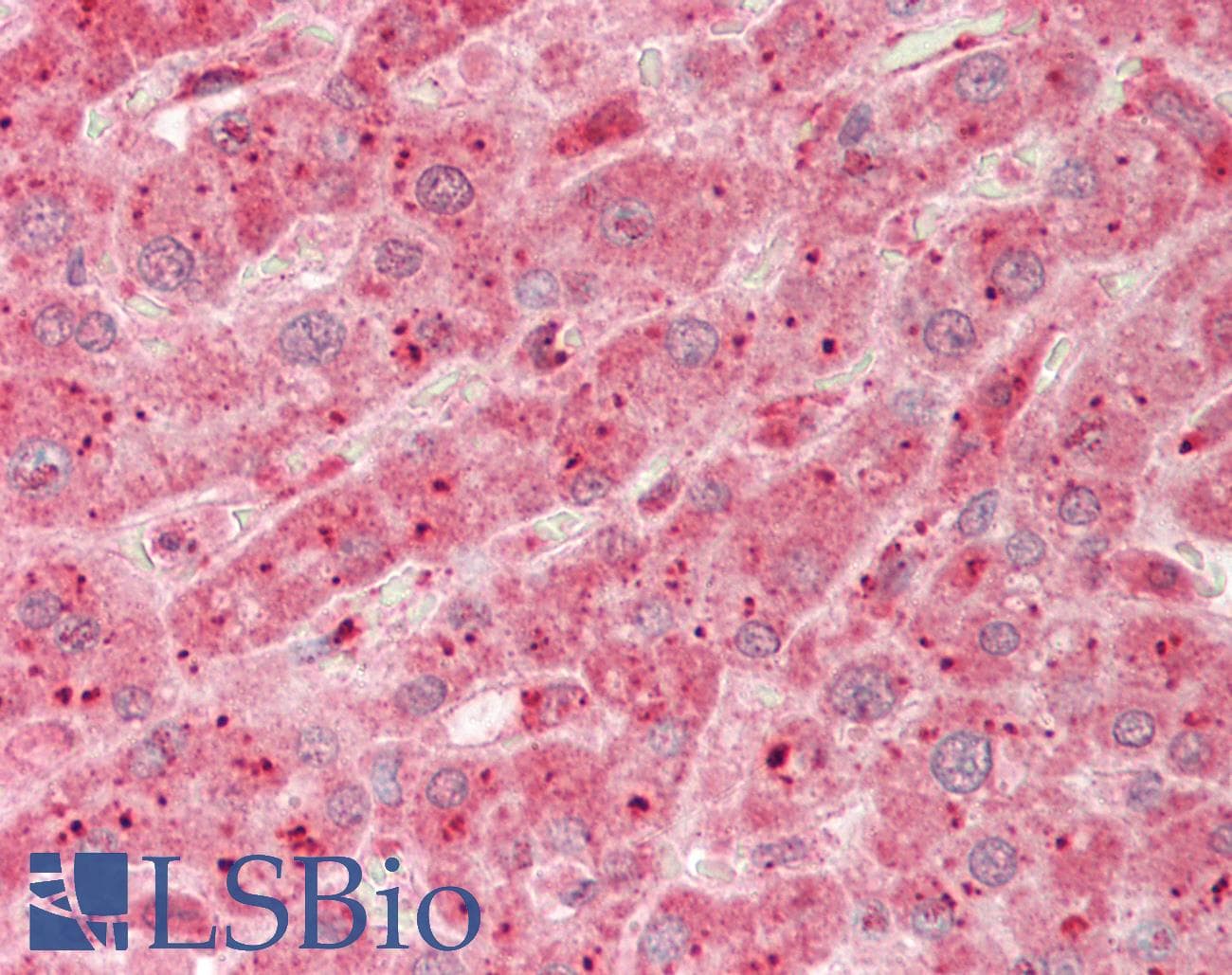 Polyclonal Rabbit anti-Human TMPRSS4 Antibody (aa71-120, IHC, WB)