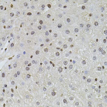 PLK4 / SAK Antibody