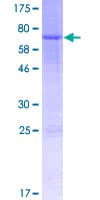Human TESPA1 / KIAA0748 Protein (Recombinant GST)