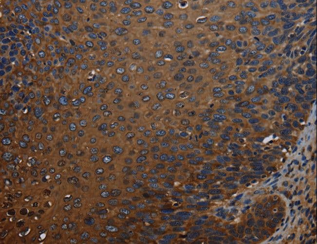IVL / Involucrin Antibody
