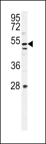 Polyclonal Rabbit anti-Human TLDC1 / KIAA1609 Antibody (aa426-456, IHC, WB)