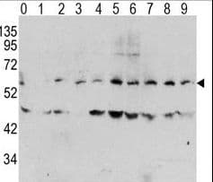 Polyclonal Rabbit anti-Human MYC / c-Myc Antibody (phospho-Thr58, WB)