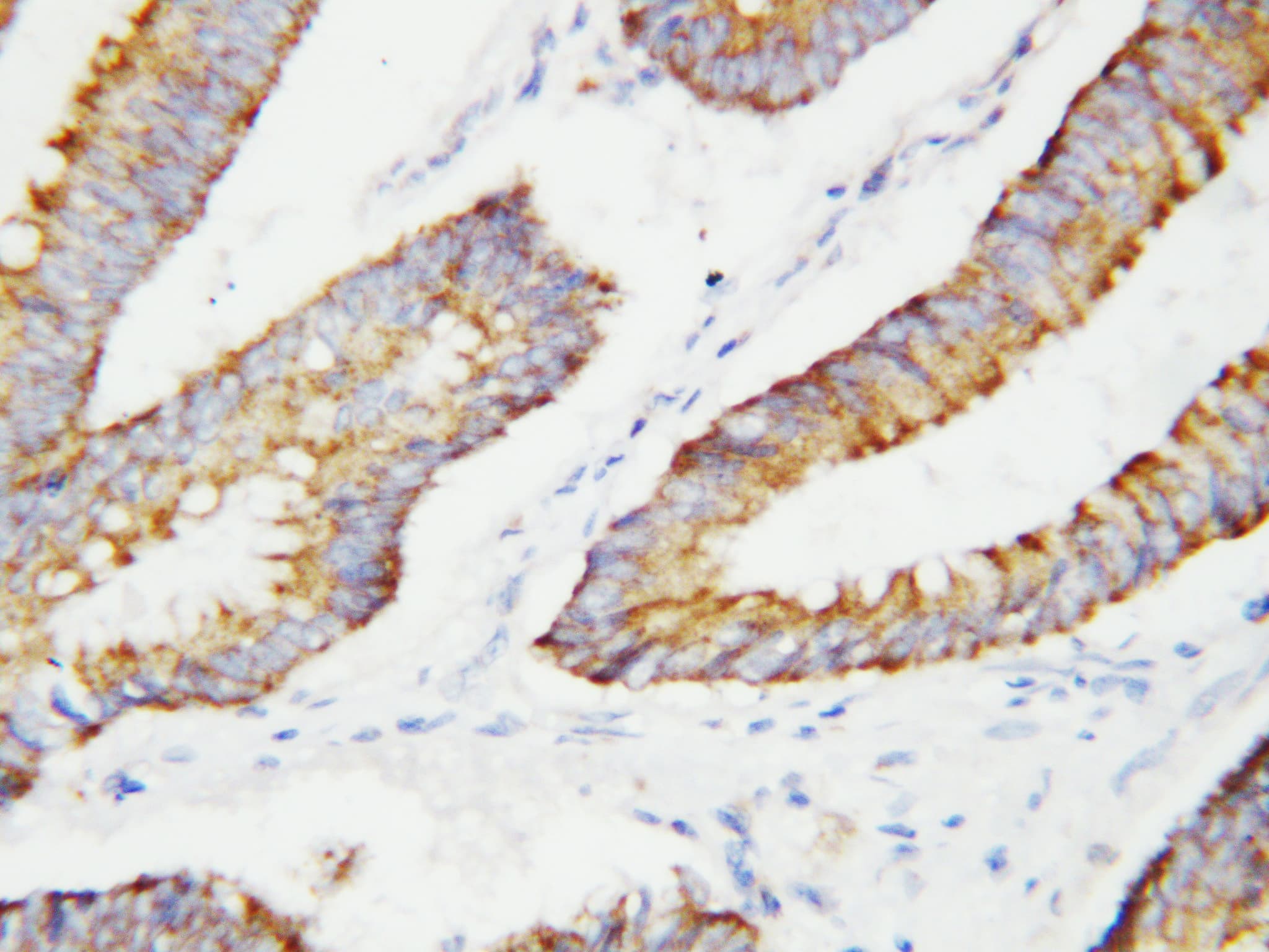 BCAT2 Antibody (aa377-392)