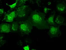 AK1 / Adenylate Kinase 1 Antibody (clone OTI8A1)