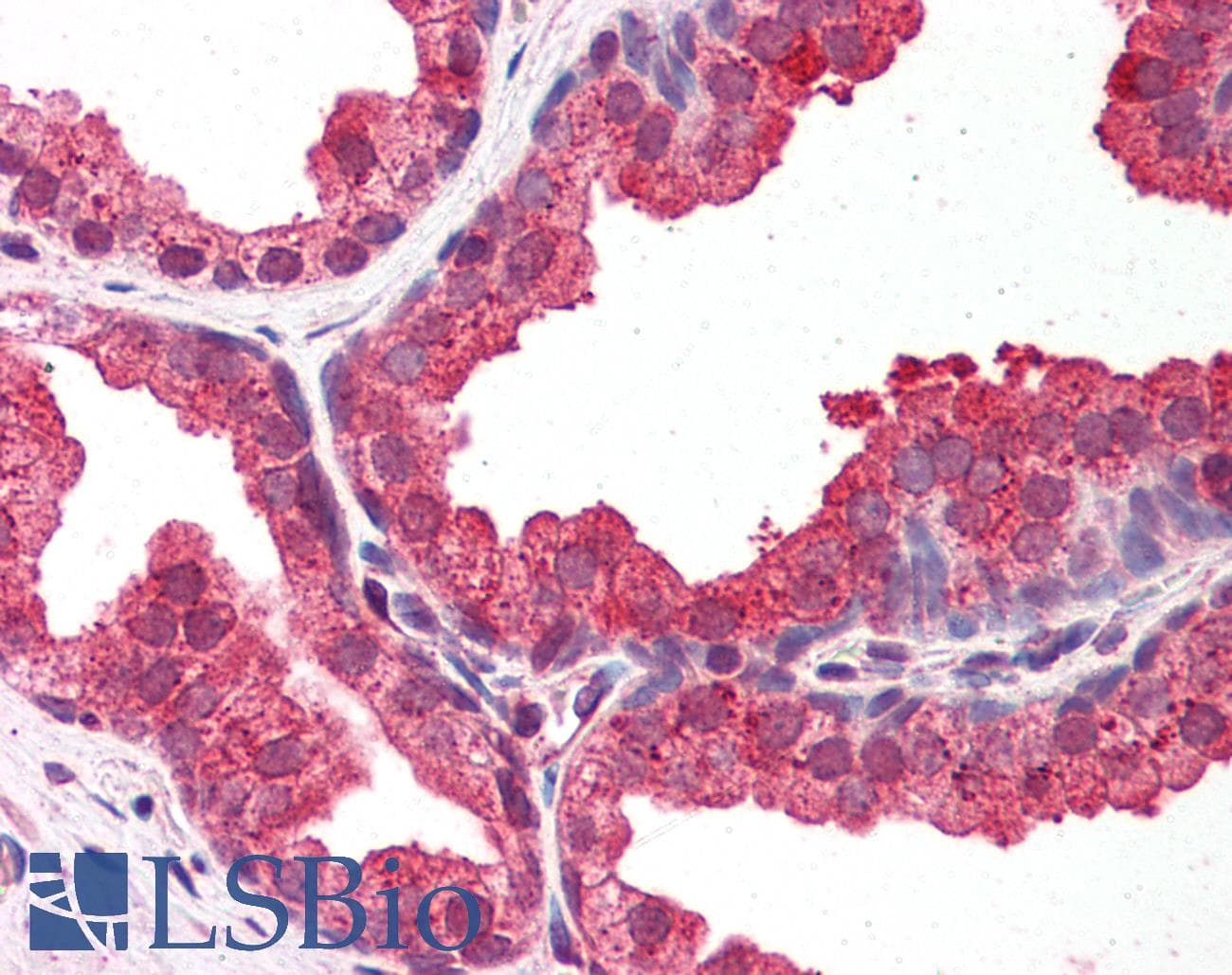 Polyclonal Rabbit anti-Mouse DYRK / DYRK1A Antibody (aa22-71, IHC, WB)