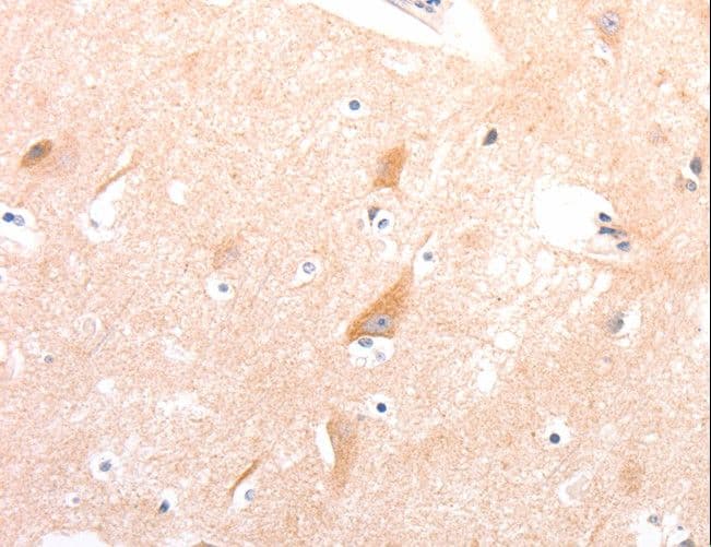 Polyclonal Rabbit anti-Human CELSR2 Antibody (IHC)