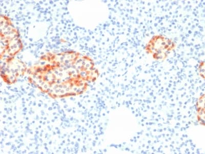 CHGA / Chromogranin A Antibody (clone rCHGA/798)