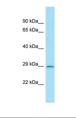Polyclonal Rabbit anti-Human IL3RA / CD123 Antibody (aa51-100, WB)