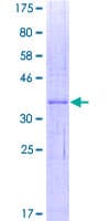 Human IFI27 / p27 Protein (Recombinant GST)