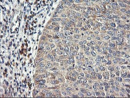 RGS16 Antibody (clone OTI1F3)