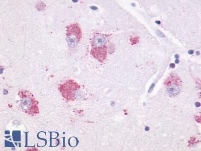PathPlus™ Polyclonal Rabbit anti-Human MTNR1A / Melatonin Receptor 1a Antibody (Cytoplasmic Domain, IHC)
