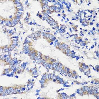DEPTOR / DEPDC6 Antibody