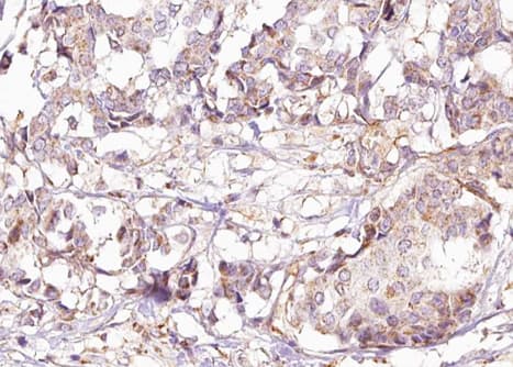 p66 / SHC Antibody (phospho-Tyr427)