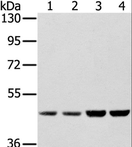 SSB / La Antibody