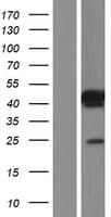 Human SPATC1L / C21orf56 Protein (Over-Expression Lysate Myc-DDK (Flag))