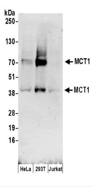 SLC16A1 / MCT1 Antibody (aa200-250)