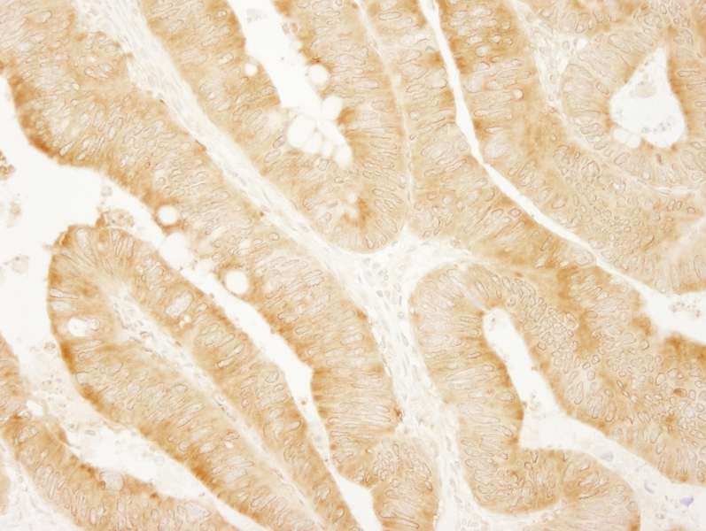 PARP4 / VPARP Antibody (aa1674-1724)