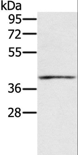 IFNGR2 Antibody