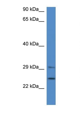 YWHAB / 14-3-3 Beta Antibody (aa70-119)