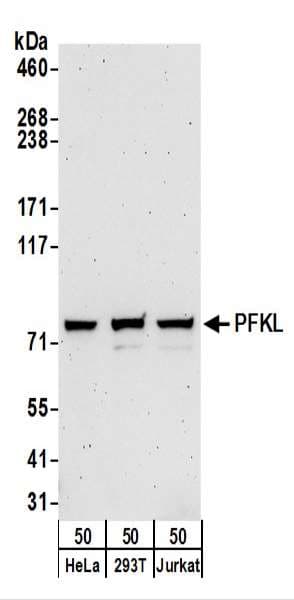 Polyclonal Rabbit anti-Human PFKL Antibody (aa1-50, WB)